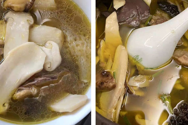 子宮肌瘤可以吃松茸嗎